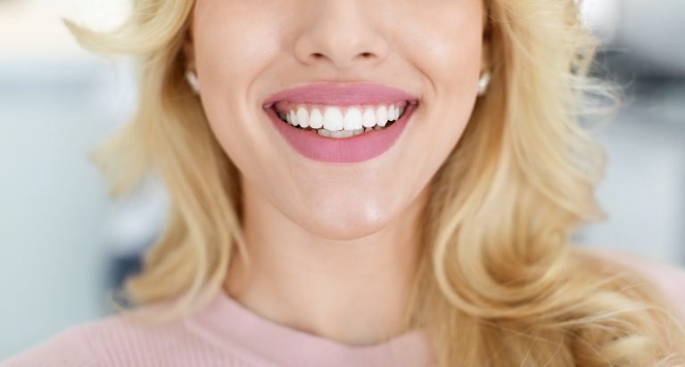 Blonde lady showing beautiful white teeth, cropped